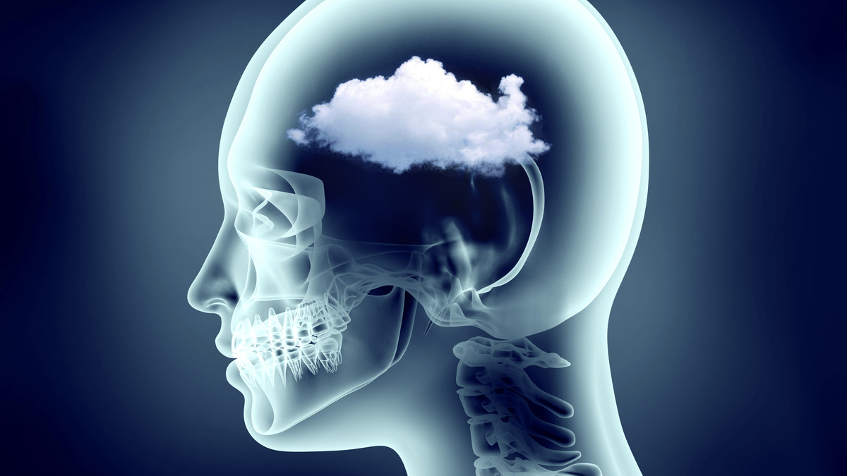 how-to-get-rid-of-brain-fog-and-avoid-it-19-surefire-ways