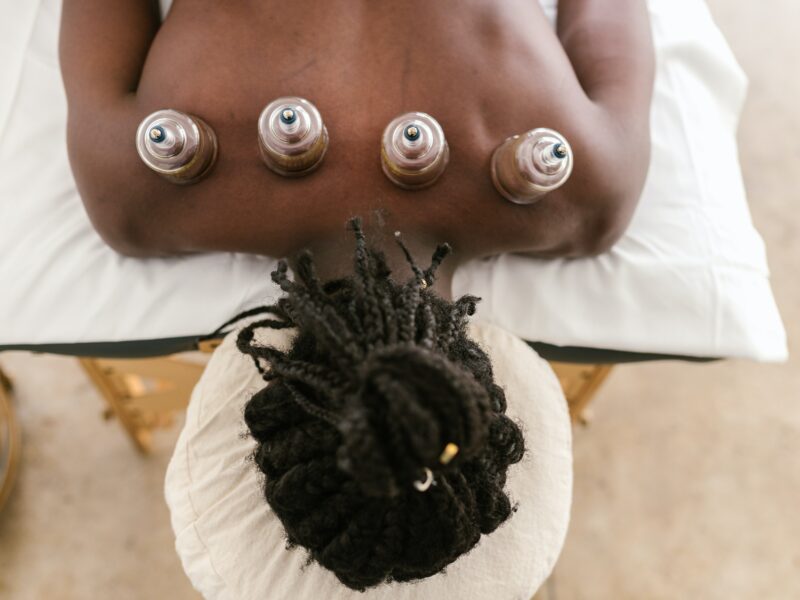 man lying on a massage table getting cupping therapy