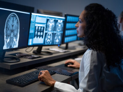 Side view of female radiologist looking at the MRI image of the head on her monitor and analyzing it; healthy brain, citicoline benefits concept